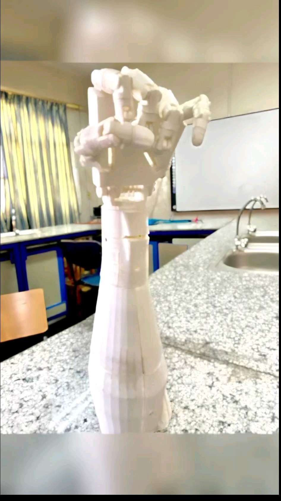prosthetic hand