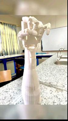 prosthetic hand